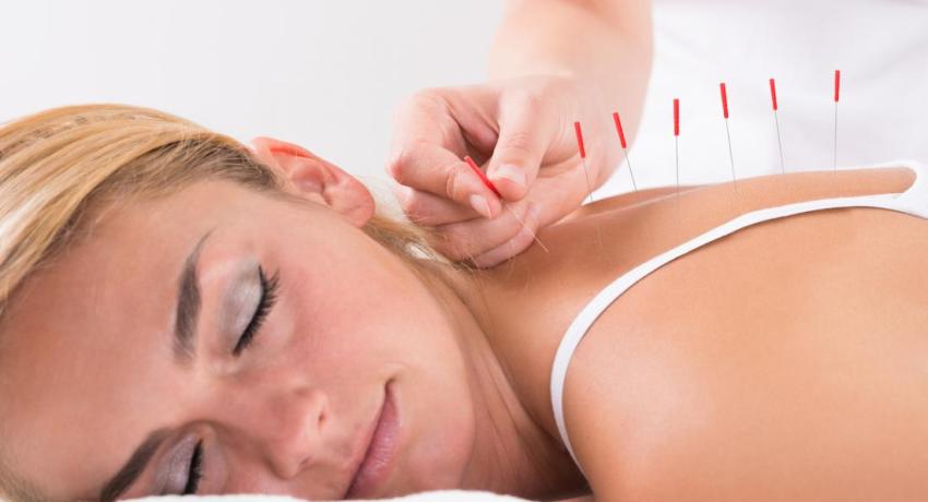 Mujer recibiendo tratamiento de Acupuntura