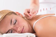 Mujer recibiendo tratamiento de Acupuntura